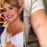 Juiz confirma agressão, mostra hematomas em sua esposa e diz que vai processar o ex-deputado e seu filho Juiz confirma agressão, mostra hematomas em sua esposa e diz que vai processar o ex-deputado e seu filho