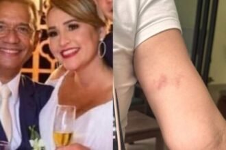 Juiz confirma agressão, mostra hematomas em sua esposa e diz que vai processar o ex-deputado e seu filho