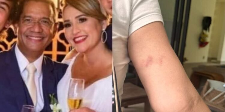 Juiz confirma agressão, mostra hematomas em sua esposa e diz que vai processar o ex-deputado e seu filho Juiz confirma agressão, mostra hematomas em sua esposa e diz que vai processar o ex-deputado e seu filho